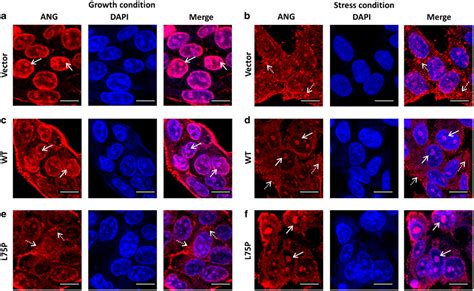 Confocal Microscopy Analyses Of Subcellular Localization Of Ang A And