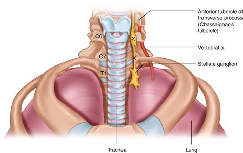 Stellate Ganglion Block SGB Ashmore Osteopathic GroupAshmore