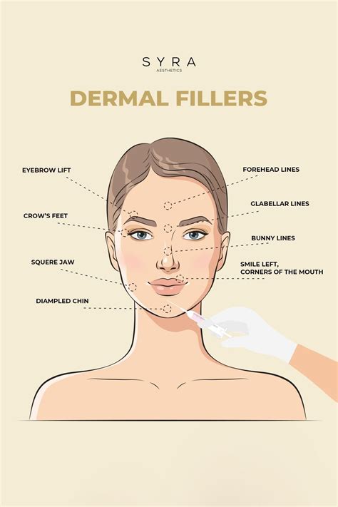 Dermal Fillers Treatment Artofit