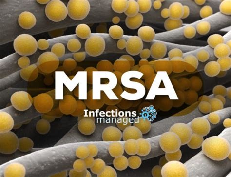 MRSA – Causes, Symptoms, Treatment & Prevention | Infections Managed