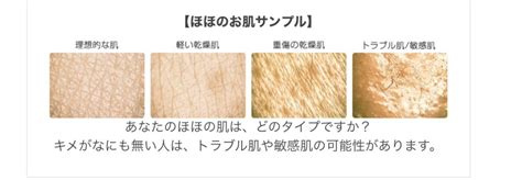 log