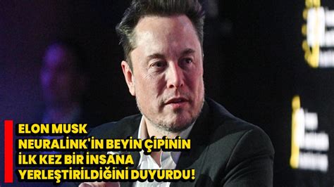 Elon Musk Neuralink In Beyin Ipinin Ilk Kez Bir Insana