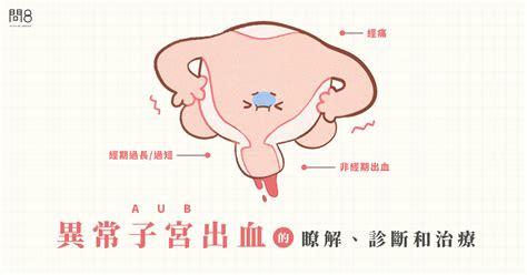 【應宗和醫師】異常子宮出血（aub）的瞭解、診斷和治療 問8健康諮詢