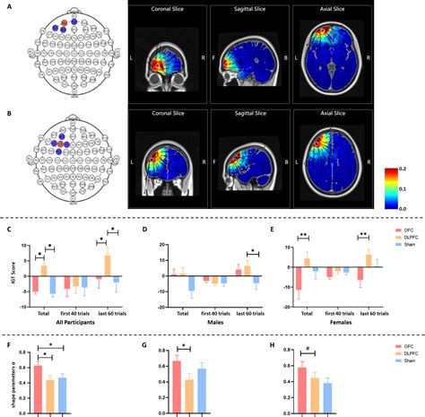 Sex Modulates The Effect Of HD TDCS Over The Prefrontal Cortex On The