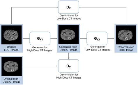 Unsupervised Medical Image Denoising Using CycleGAN MATLAB Simulink