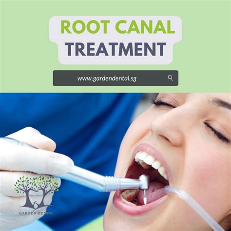 Ppt What Is Root Canal Treatment Powerpoint Presentation Free Download Id 11512831