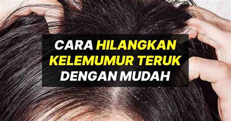 Cara Nak Hilangkan Kelemumur Rambut Jan Watson