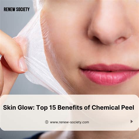 15 Chemical Peel Benefits: Medspa in McKinney, TX