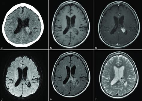 Preoperative Computed Tomography Ct And Magnetic Resonance Images