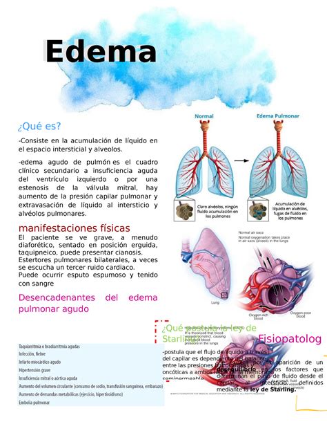 Acute pulmonary edema Edema Edema Qué es Consiste en la