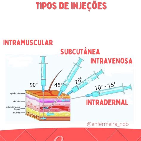 tipos de injeções - Enfermagem 