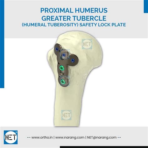 Proximal Humerus Greater Tubercle Humeral Tuberosity Safety Lock