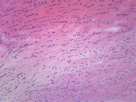 Fibrocartilage Histology Labeled