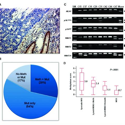 A, MSH2 immunohistochemical staining. A representative example of a CRC ...