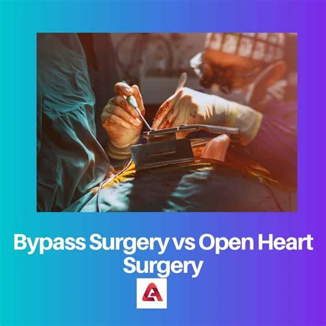 Bypass Vs Open Heart Surgery Difference And Comparison