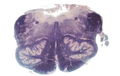 Neuro Anatomy Brainstem Cross Sections Flashcards Quizlet