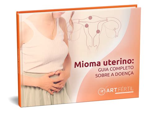 Mioma uterino guia completo sobre a doença Art Fértil