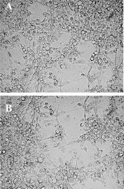 Cytopathic Effect Cpe Induced By Cngv From Gills A And Kidneys B