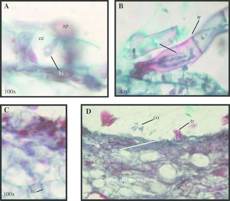 Fotomicrografías al microscopio de luz que muestran la penetración A