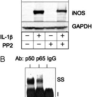 Pp Inhibits Il Induction Of Nf B Dna Binding Activity And