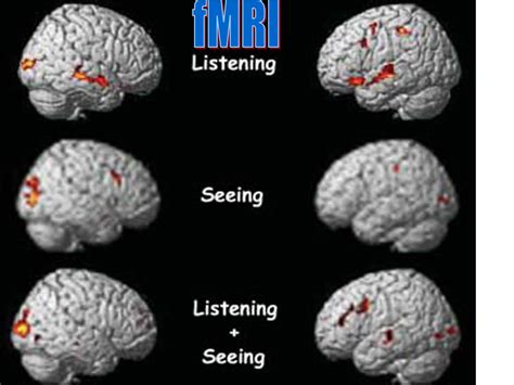 PPT - fMRI vs. MRI PowerPoint Presentation, free download - ID:6066896