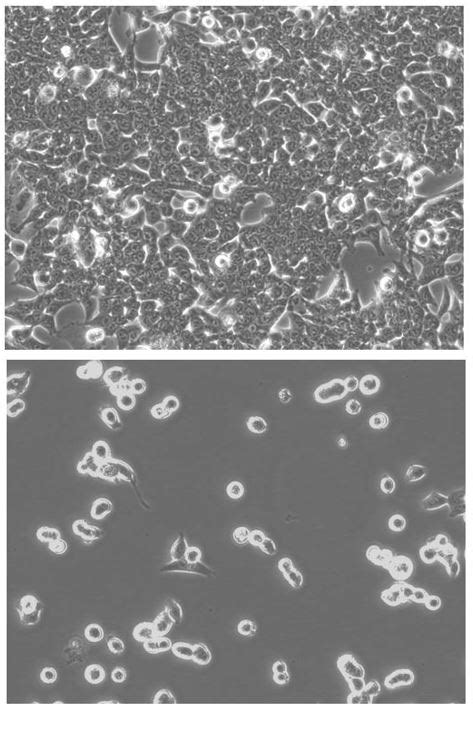 Hct Irfp Puro Reporter Gene Cell Line Imanis Life Sciences