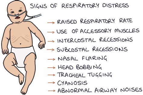 Bronchiolitis Zero To Finals