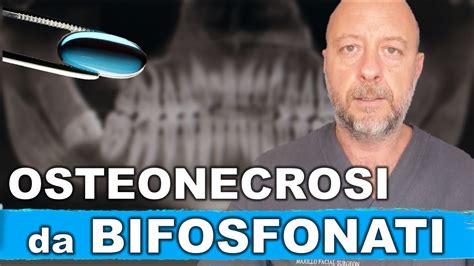 Osteonecrosi da bifosfonati tra gli effetti collaterali vi è la