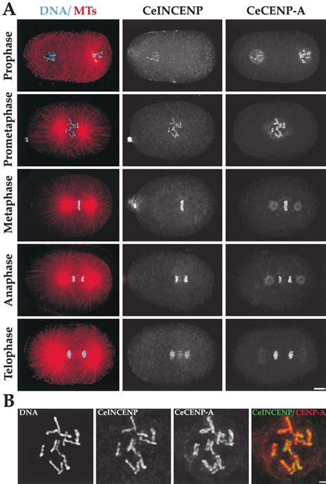 CeINCENP Localizes To The Chromosomal Region Between The Two