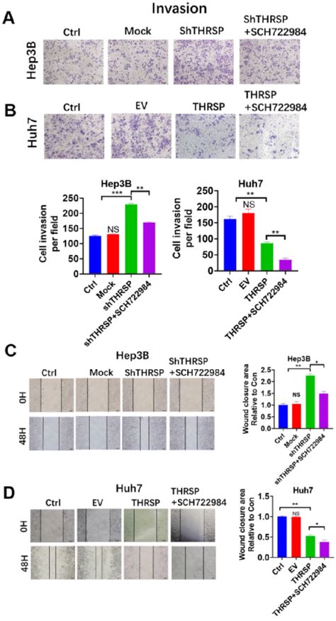 Thrsp Abolished Cell Migration Of Hcc In An Erkzeb1 Dependent Manner