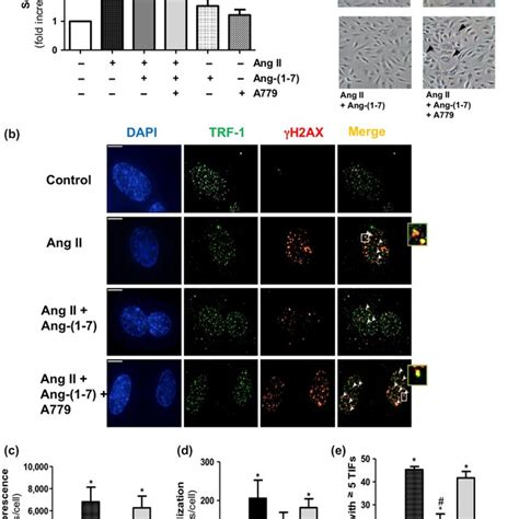 Ang 17 Counteracts Endothelial Cell Senescence And DNA Damage