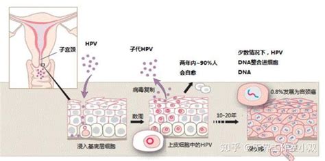 这可能是全网最深度的宫颈癌解读了，强烈建议收藏！！！ 知乎