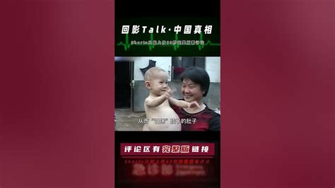 一歲半女童離奇“懷孕”，醫生做手術剛開了口，嬰兒自己蹦出來了 Youtube