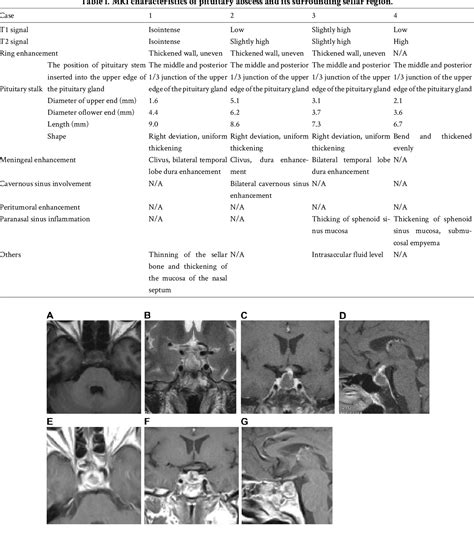 Figure 1 From Abnormal Magnetic Resonance Imaging Of The Sellar Region