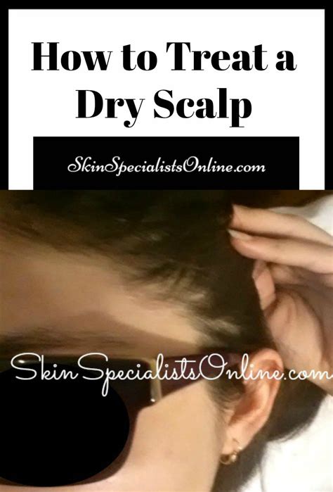 Dry Scalp Causes and Treatment - Skin Specialists Online