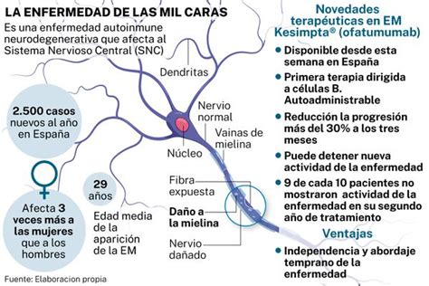 Estos Nuevos Hitos Terapéuticos Acorralan A La Esclerosis Múltiple Asociación Española De