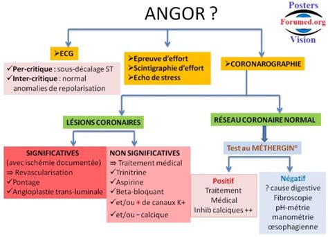 Orientation diagnostique devant ANGINE DE POITRINE ANGOR Santé Médecine