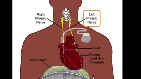 Phrenic Nerve Anatomy - Anatomical Charts & Posters