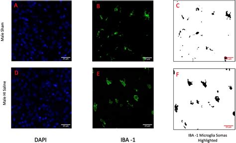 Biomedicines Free Full Text Sex Differences In Microglia Activation In A Rodent Model Of