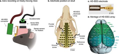 Recording Of Eeg A Schematic Illustration Of The Recording