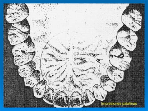 Metodos De Identificacion Odontografica Ppt