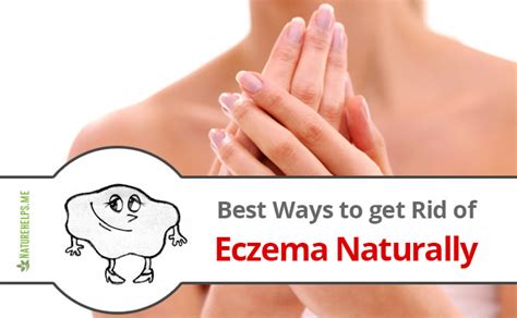 Best Ways to get Rid of Eczema Naturally