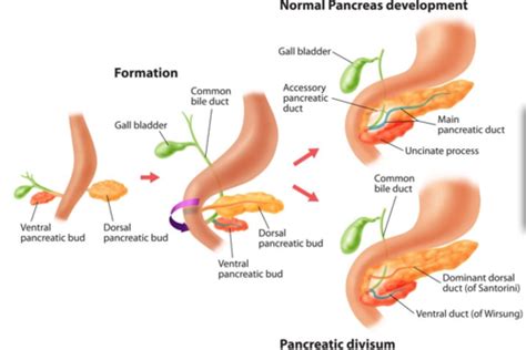 Normal Anatomy Lesson Pancreas Normal Variants Flashcards Quizlet