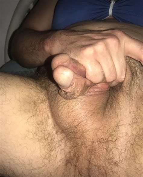 Subincision Gallery 10 Nude Pics XHamster