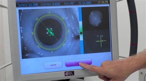 Ora Verifeye Used In Laser Cataract Surgery With The Crystalens