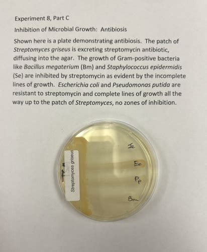 Micro Lab Final Flashcards Quizlet