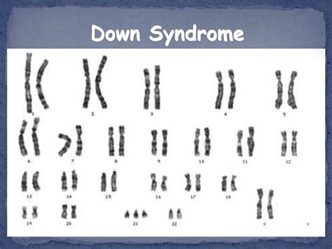 Ppt Pedigrees And Karyotypes Powerpoint Presentation Free Download