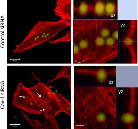 Actin Cytoskeleton Organization During Micro Particle Treatment After