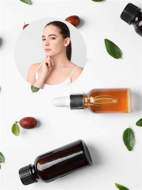 How To Use Jojoba Oil For Acne