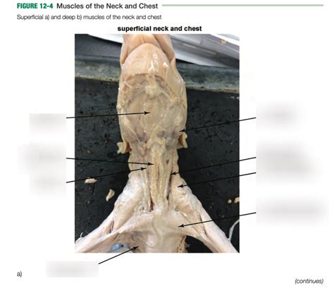 fetal pig (3) Muscles of the Neck and Chest Diagram | Quizlet